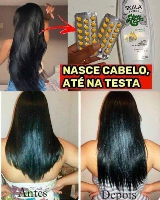 Isso vai fazer o cabelo crescer rápido como foguete