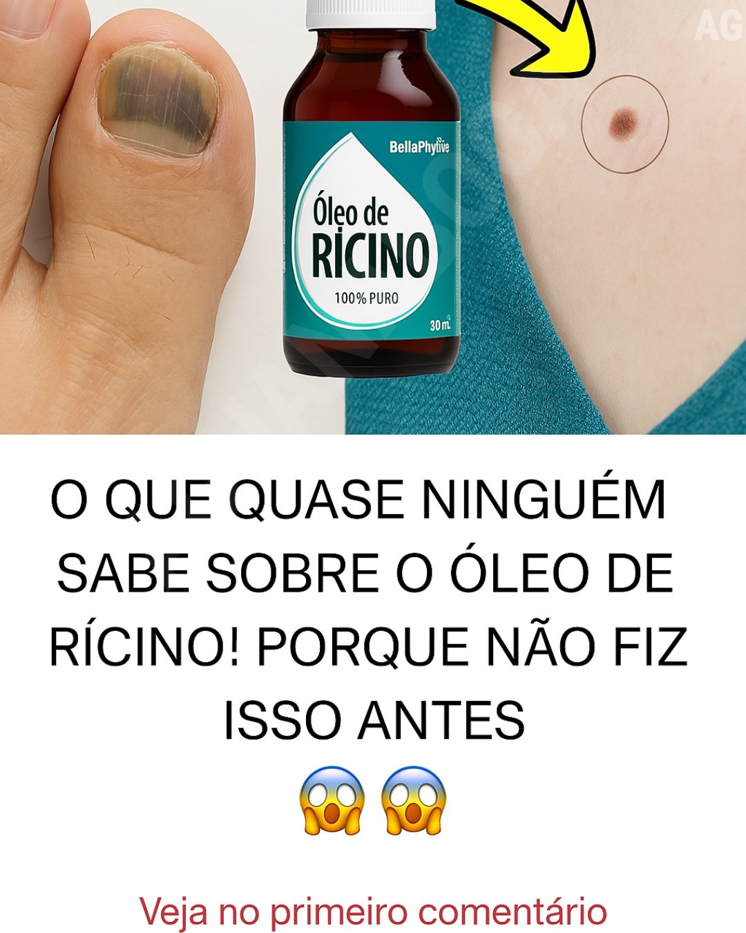 O que quase ninguém sabe sobre o óleo de rícino!