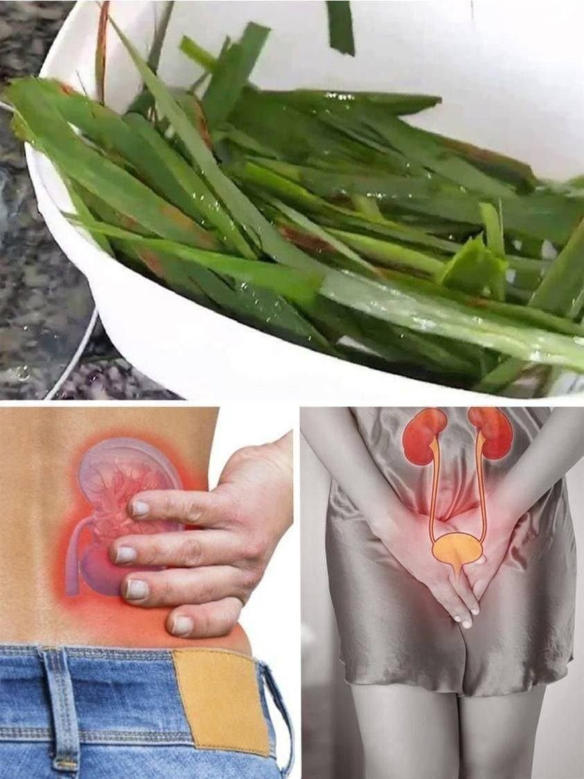 Acaba com Infecção Urinária Dores e Inflamação nos Rins