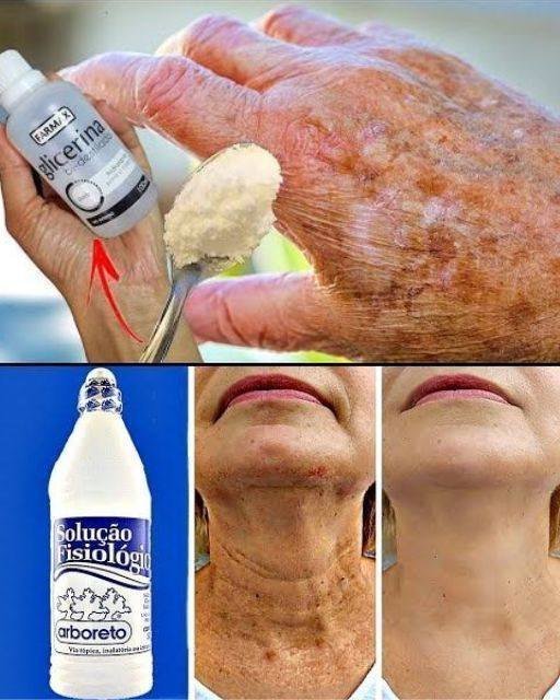 Use para Remover Manchas e Rugas e ter Pele de Bebê em Poucos Dias